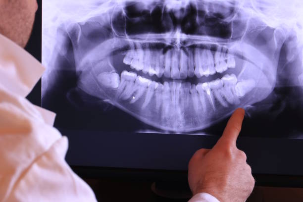 Best Tooth Infection Emergency Dentist  in Haymarket, VA